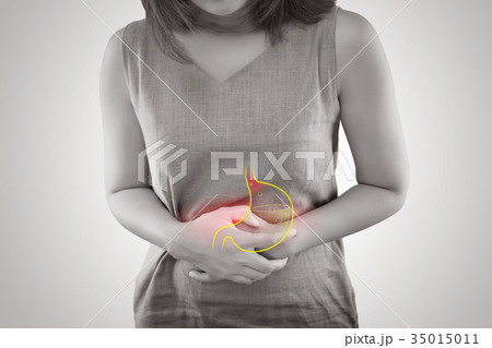 Gastroesophageal reflux disease Gastroesophageal reflux disease 35015011