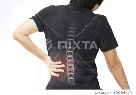 spine bones injury spine bones injury 35064577