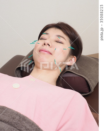 美容鍼灸をする女性 35088215