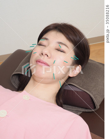 美容鍼灸をする女性 35088216
