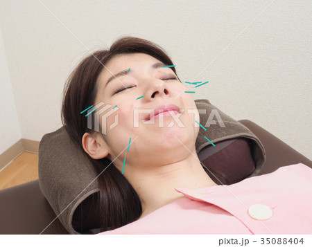 美容鍼灸をする女性 美容鍼灸をする女性 35088404