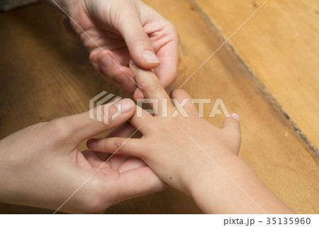 手足口病 手足口病 35135960