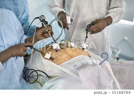 Laparoscopy operation process 35168769