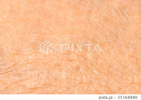 Texture of the skin 35168880