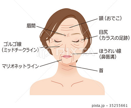女性の顔　シワ　美容 35255661