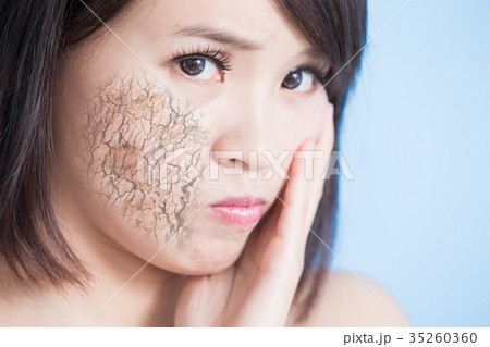 woman with dry skin woman with dry skin 35260360