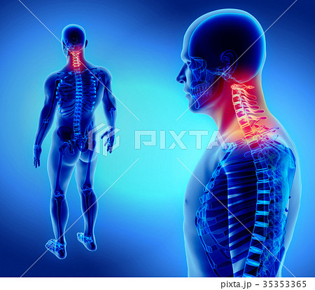 3D illustration of Cervical Spine, medical concept 35353365