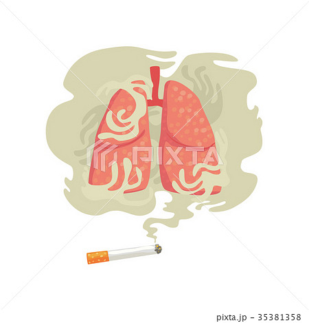 Cigarette smoke and lungs, bad habit, dangers of Cigarette smoke and lungs, bad habit, dangers of 35381358