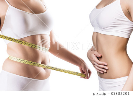 Woman's body before and after weight loss. Woman's body before and after weight loss. 35382201