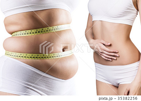 Woman's body before and after weight loss. Woman's body before and after weight loss. 35382256