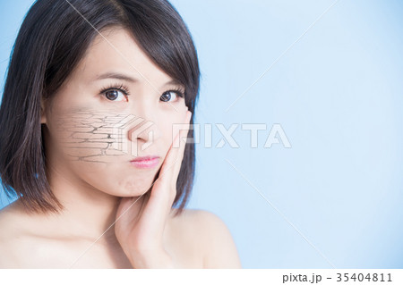 woman with dry skin woman with dry skin 35404811