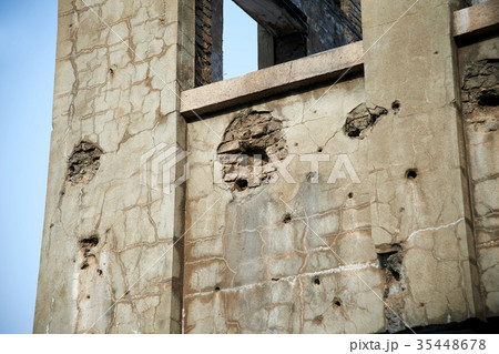 労働当社 韓国戦争 痛み 35448678