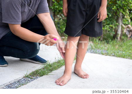 Mother spraying insect repellents on her son leg 35510404