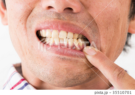 デンタルケア デンタルケア 35510701