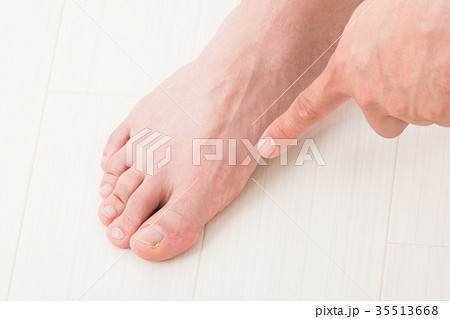 男性の足 35513668
