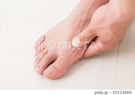 男性の足 男性の足 35513669