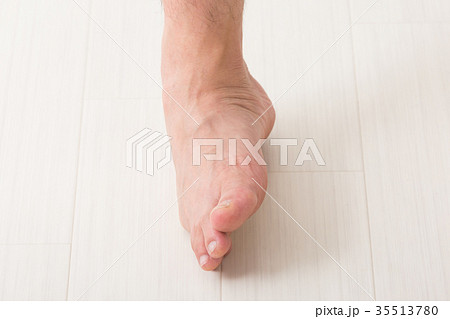 男性の足 男性の足 35513780