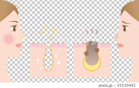 Pore Before After Pore Before After 35530491