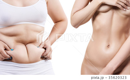 Woman's body before and after a diet 35620323