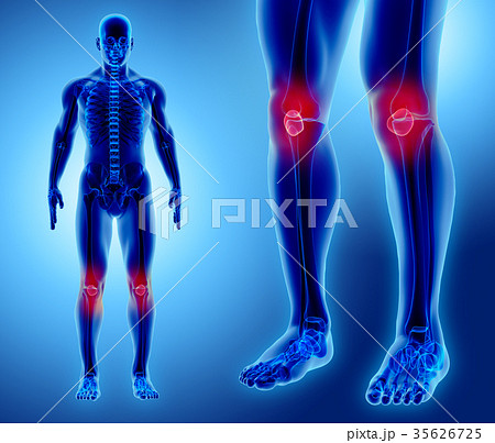 3D illustration of Patella, medical concept. 35626725