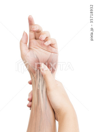 wrist muscle pain 35718932