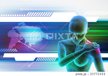 young woman touching her painful elbow 35772433