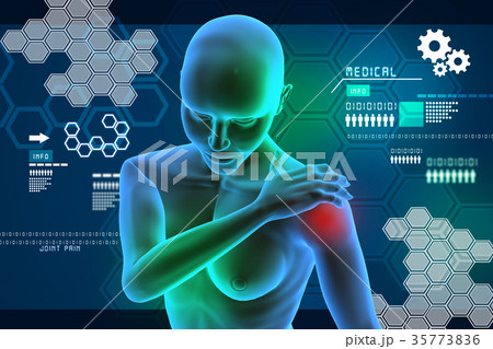 young woman touching her painful elbow young woman touching her painful elbow 35773836