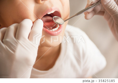 歯のチェック　（ソフトフォーカス） 35825185