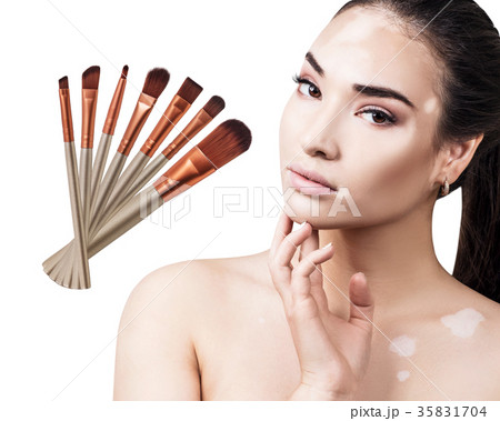 Woman with vitiligo and many makeup brushes. 35831704