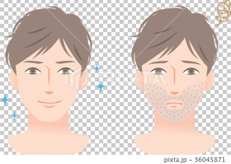 男性　ヒゲ　ビフォアアフター 36045871