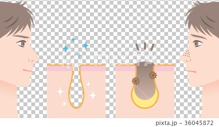 男性護膚毛孔 36045872