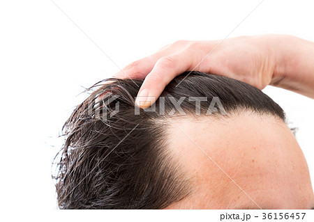 ヘアケア 36156457