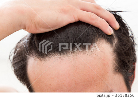 ヘアケア 36158256