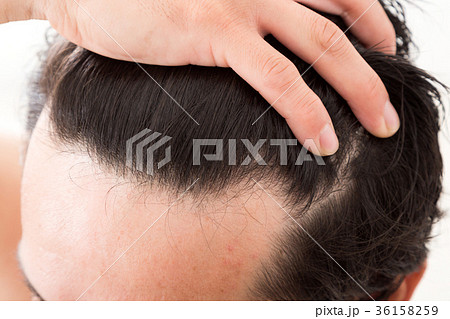 ヘアケア ヘアケア 36158259