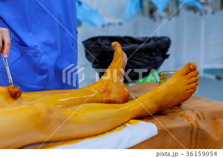 nurse and doctor prepare patient  surgery patient 36159054