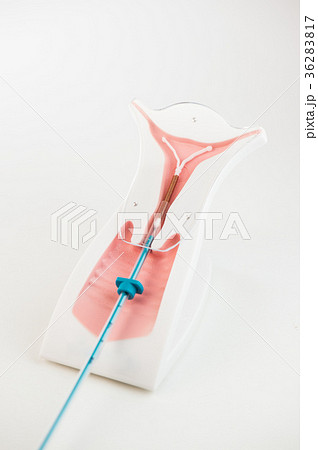 Birth control symbol iud on white background 36283817