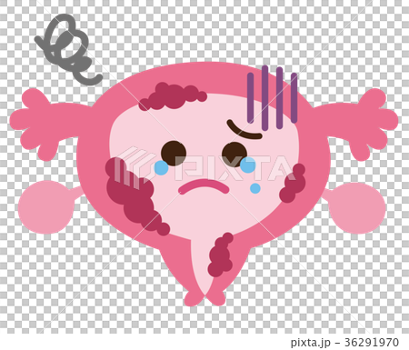Uterine cancer disease Uterus character 36291970