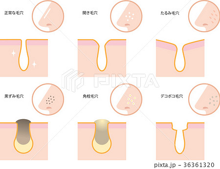 Skin care pores - Stock Illustration [36361320] - PIXTA