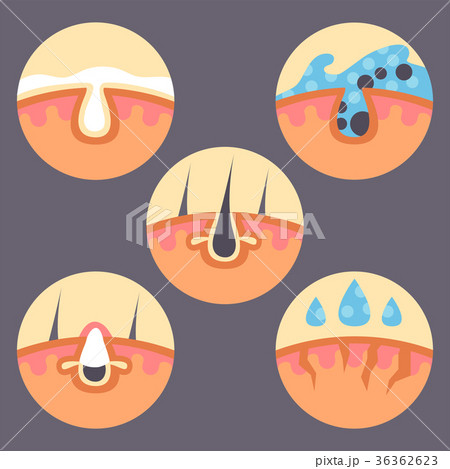 Facial care skin problems vector clean 36362623