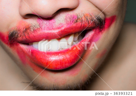 Mouth stained the color of lipstick. 36393321