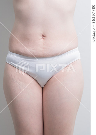 Fat overweight woman 36397780