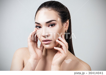 Portrait of beautiful woman with vitiligo. 36414041