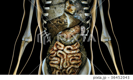 Sick Internal Organs Human Body Anatomical Conc 36452043
