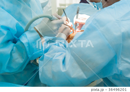 Close up dental surgery process - Implantation.  36496201