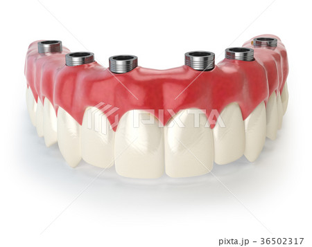 Dental prothesis isolated on white Dental prothesis isolated on white 36502317