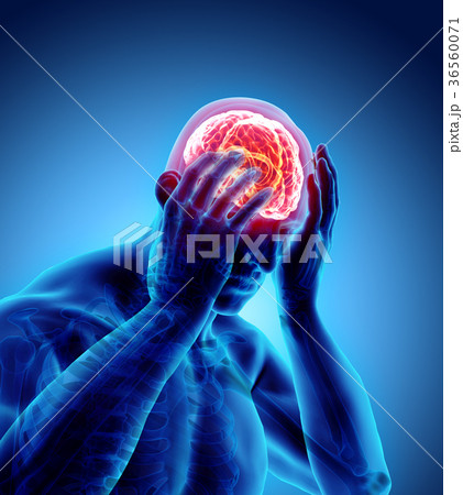 3d illustration of headache human. 36560071