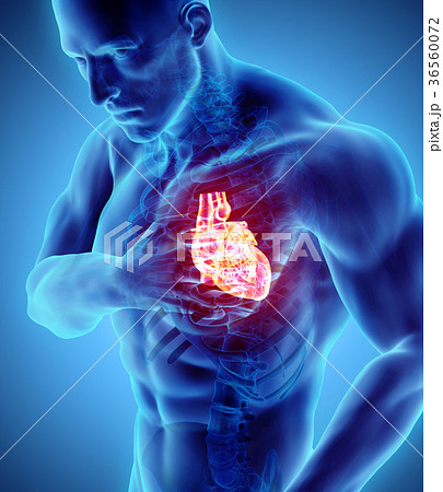 3d illustration of human heart attack. 36560072