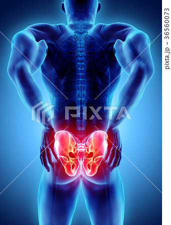 Hip painful skeleton x-ray, 3D illustration. 36560073