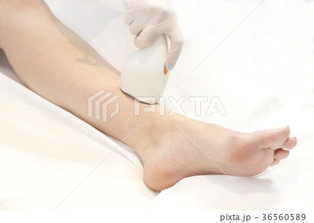 The process of laser depilation of female limbs in The process of laser depilation of female limbs in 36560589