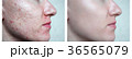 skin face.daughter 36565079